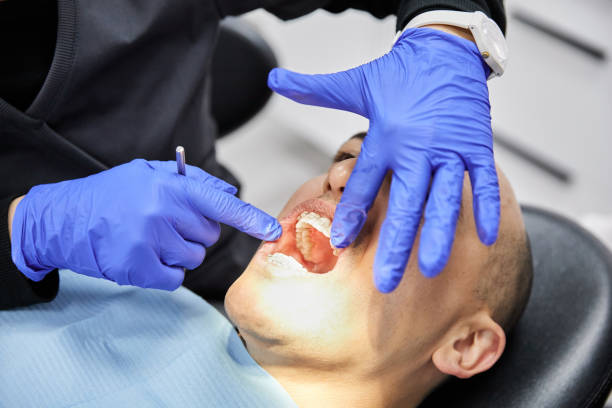 Best Emergency Tooth Extraction in Claremont, NC